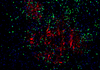 Kit de coloration à double fluorescence de Tsaplus pour la coloration double immunofluorescence de sections de paraffine
