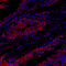 //rnrorwxhrkjnln5q-static.micyjz.com/cloud/lkBpjKnjlkSRqippqjopip/cca741b164f82a5d44f88f311d570d9b-60-60.jpg