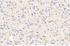 GB11181 PAB de lapin anti -yrosine hydroxylase