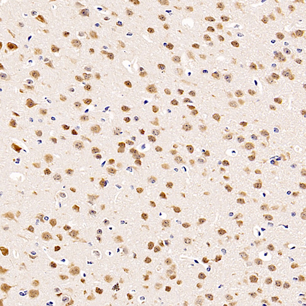 GB11138 PAB biologique anti-Neunnun